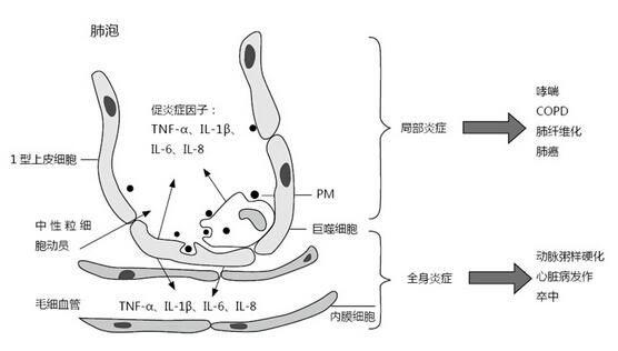 霧霾到底會(huì)不會(huì)致癌（霧霾會(huì)致癌嗎）