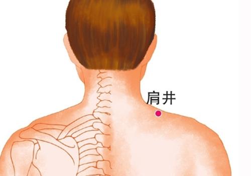 消化性溃疡拔罐位置示意图 胃溃疡拔罐部位