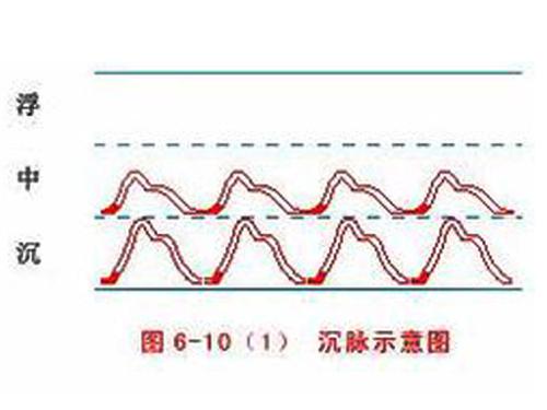 脉象沉是什么意思