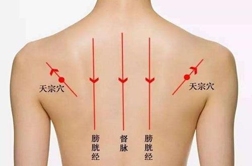 拔罐后背的位置示意图（拔罐背部位置示意图）