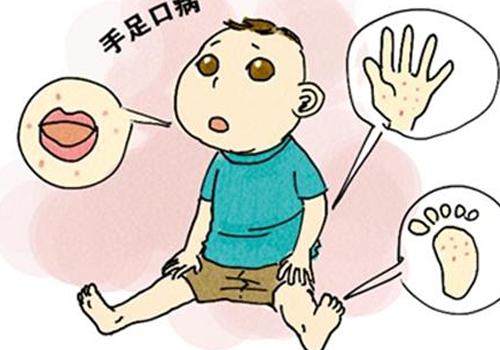 小孩手足口病几天会好 小孩手足口病多少天能好