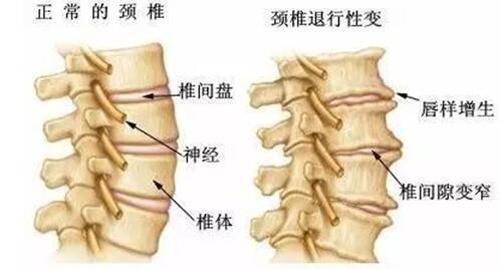 腰酸背痛是什么原因引起的 腰酸背痛是什么原因引起的男人