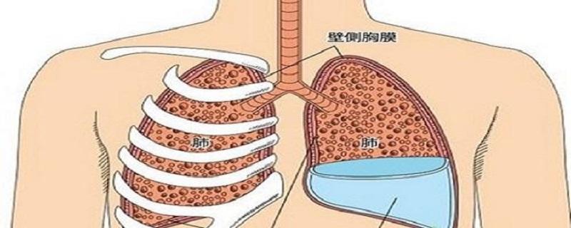 胸腔积液是怎么形成的 急性胸腔积液是怎么形成的