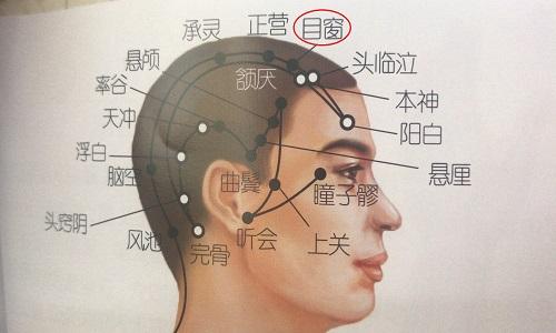 目窗的准确位置图（目窗的准确位置图视频）