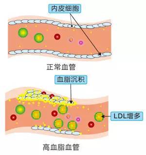 吃什么軟化血管最好