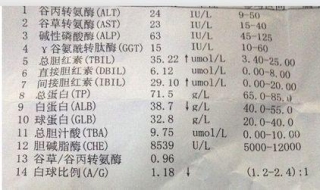 谷草转氨酶高怎么办 谷草转氨酶高的治疗注意事项