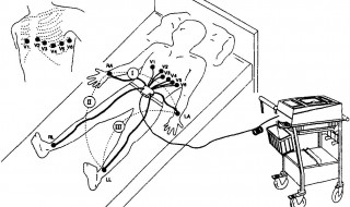 心电监护电极贴放位置 医学小常识