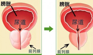 前列腺的作用是什么 前列腺的作用