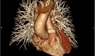 冠状动脉ct的危害 检查什么的