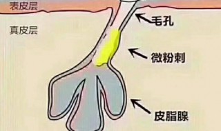 清理毛孔方法 怎么清理毛孔