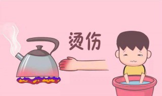 烫伤如何处理（烫伤之后怎么办）