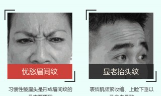 抬头纹太深怎么改善（抬头纹较深一般方法有效吗）