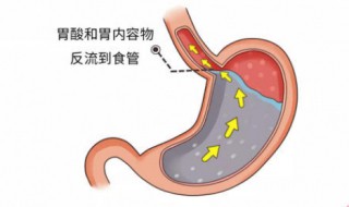 怎样养胃护胃 怎样养胃护胃最好