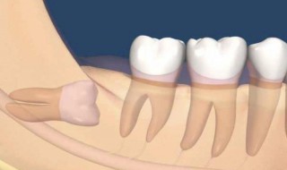 智齿不拔会怎么样（阻生智齿不拔会怎么样）