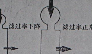 有效濾過(guò)壓是什么意思（什么叫有效濾過(guò)壓）