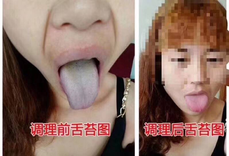 女人口臭什么原因引起，严重了是身体哪里出问题了？怎样去除