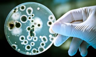 保存细菌等菌种最佳方法 常见的菌种保存方法有哪些