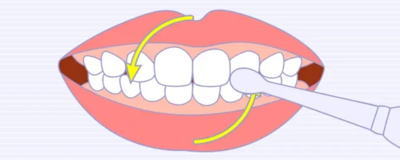 圆弧刷牙法 圆弧刷牙法视频教程