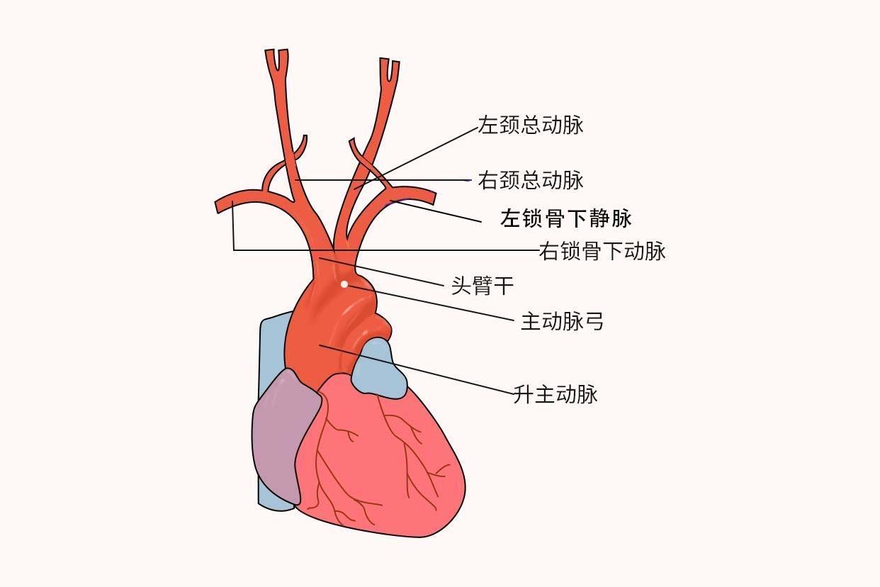 主动脉弓解剖图（主动脉弓解剖图CT图）