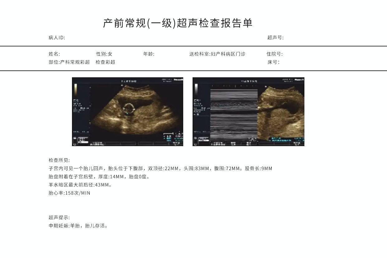 产科彩色超声报告图解