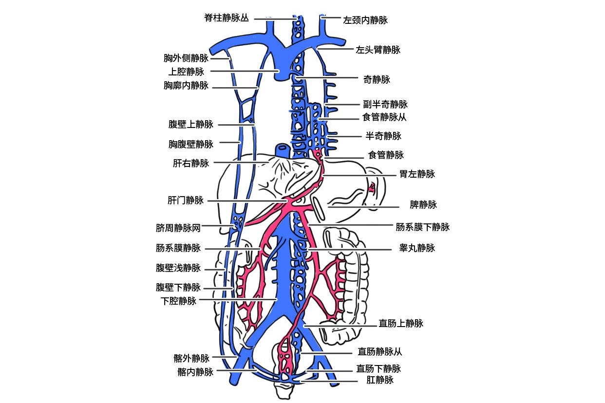 门静脉高压三个侧支循环图解