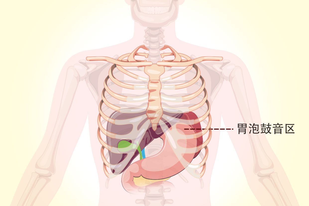 胃泡鼓音區(qū)示意圖