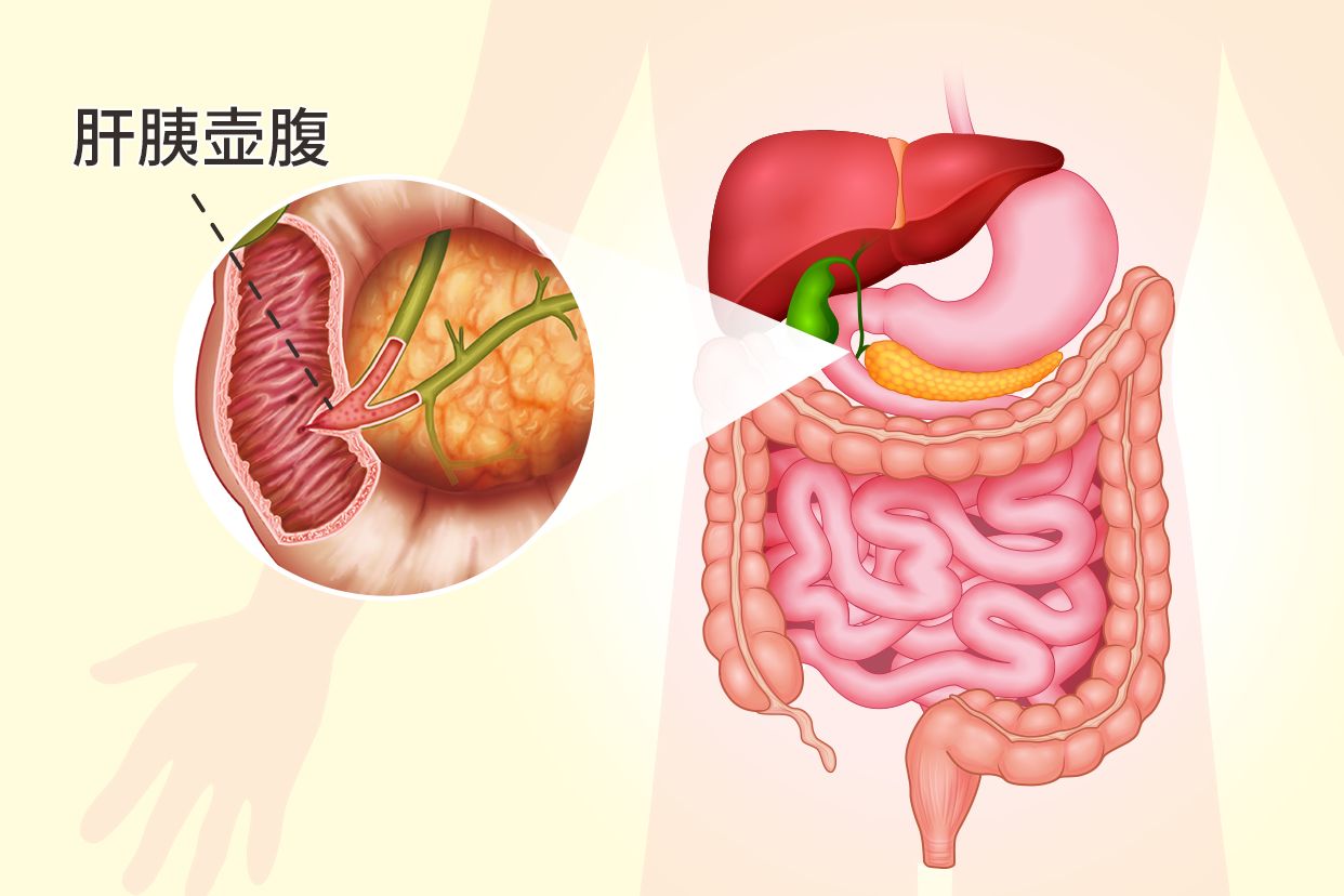 肝胰壺腹部在哪個(gè)位置圖片