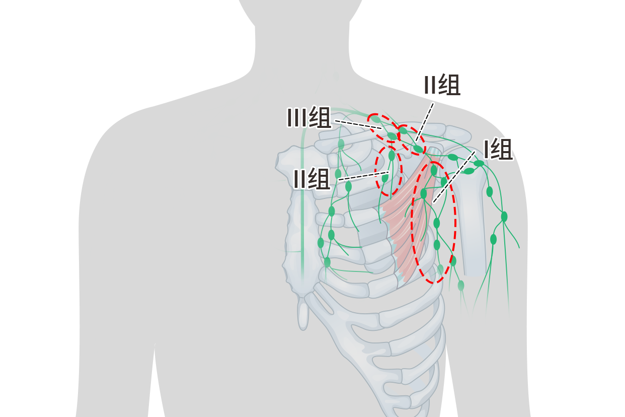 中央?yún)^(qū)淋巴結(jié)圖片