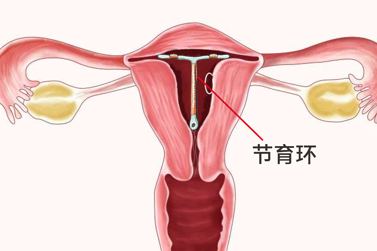 有女人上懷的子宮圖片嗎