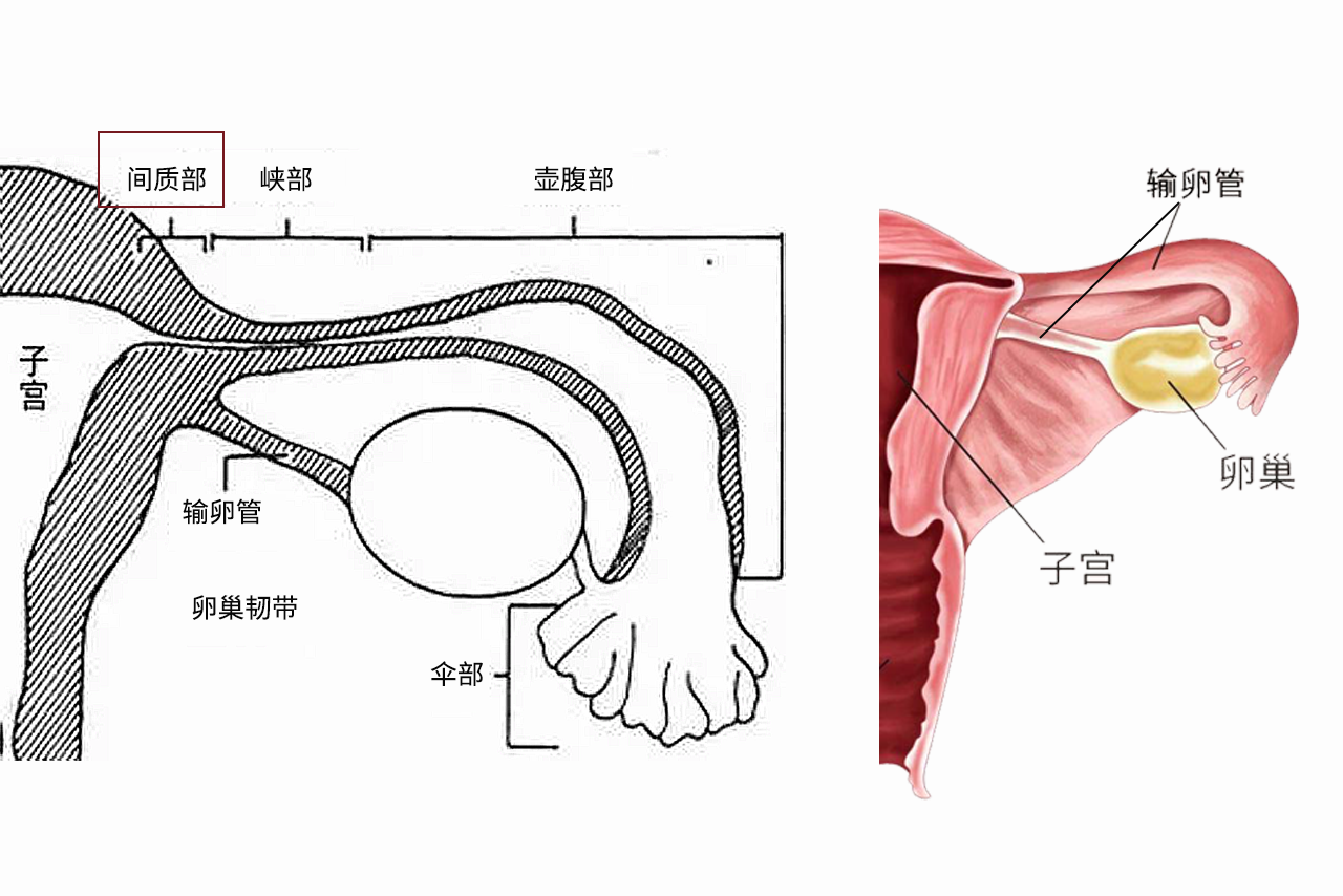 输卵管间质部图片（输卵管间质部的临床意义）