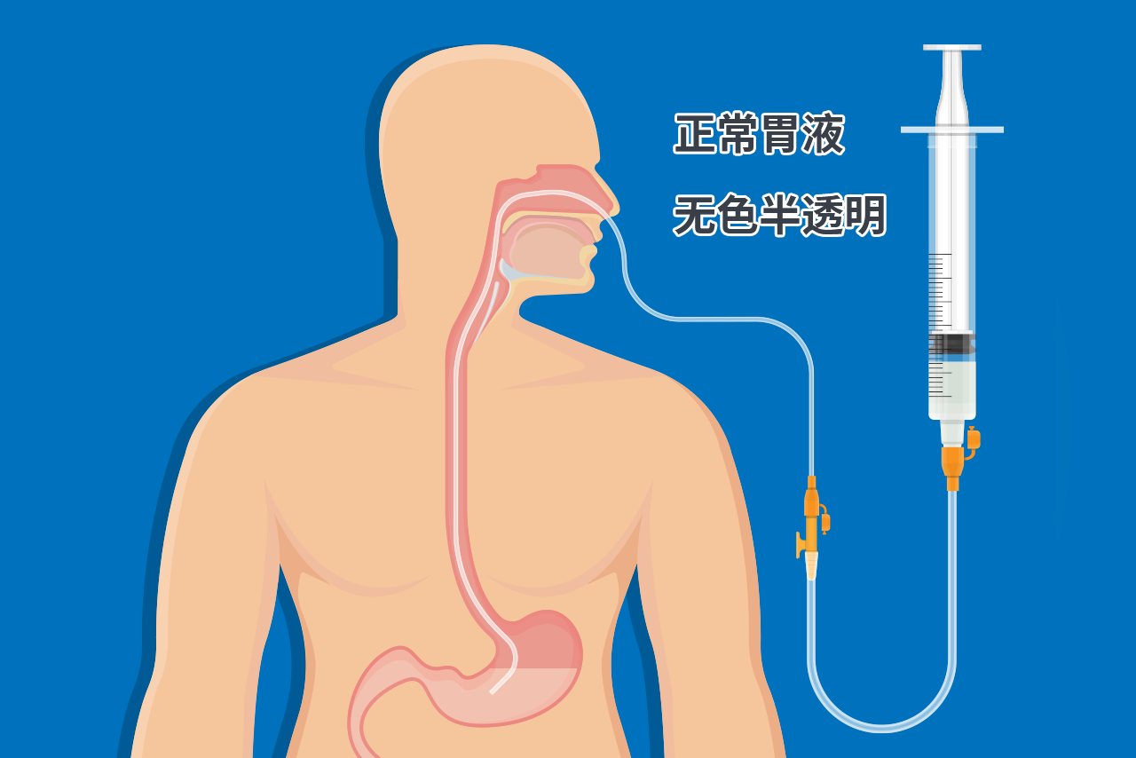 正常胃液颜色的图片 胃液正常颜色和异常如何判断