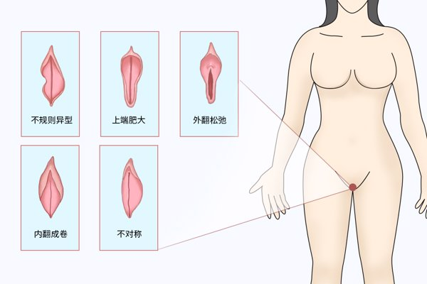 女人陰部形狀有幾種圖