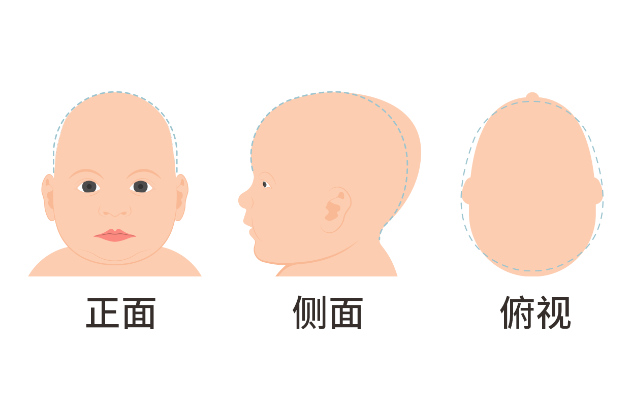 婴儿头两侧有凹陷怎么回事图片 婴儿头两侧有凹陷正常吗