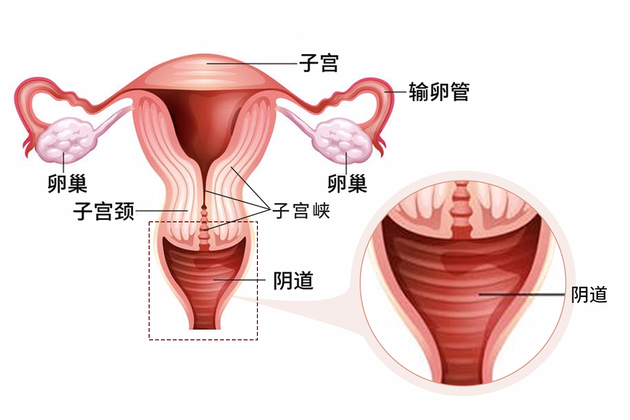 子宮下段圖片 子宮下段圖片大全