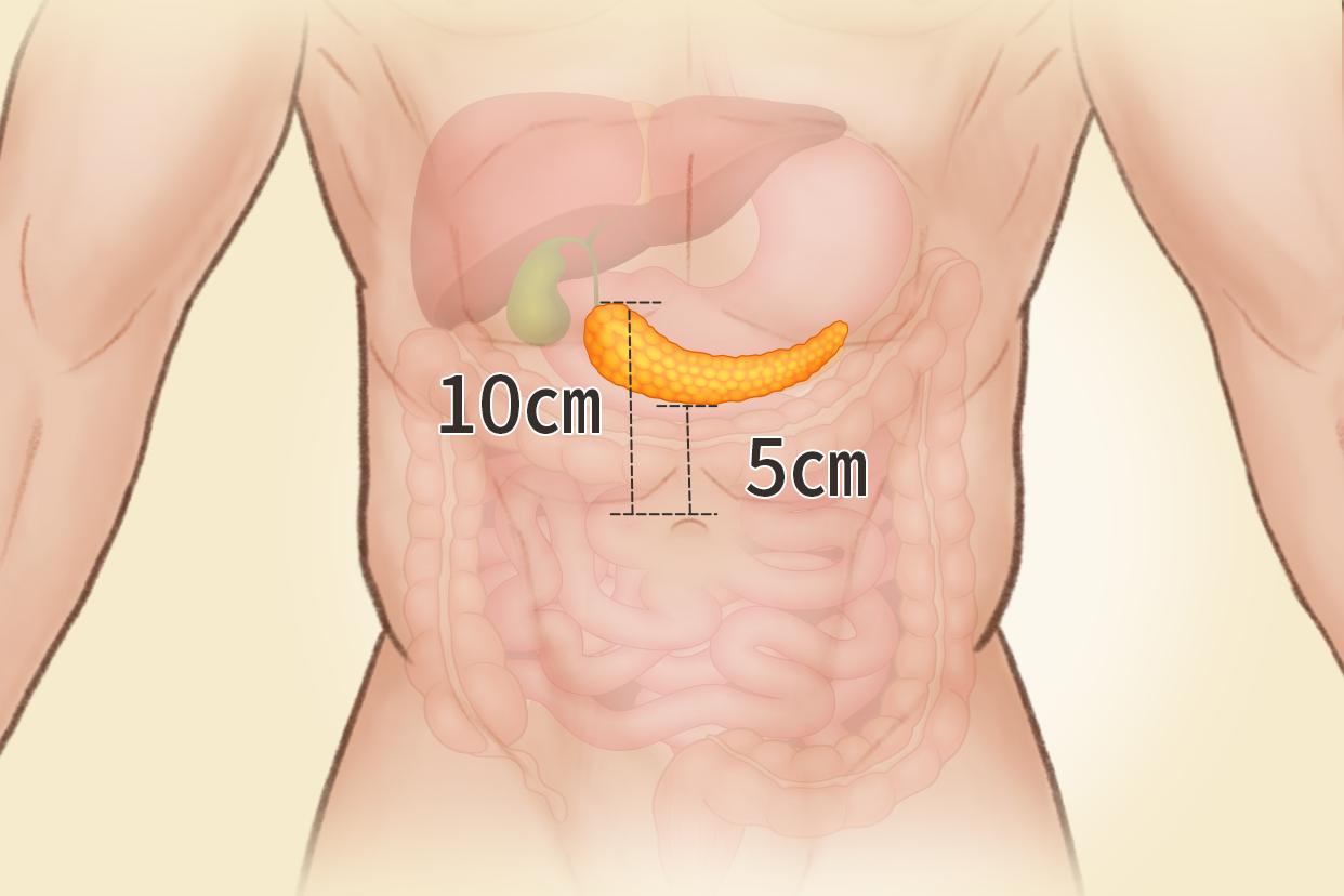 人體胰腺位置、結(jié)構(gòu)圖